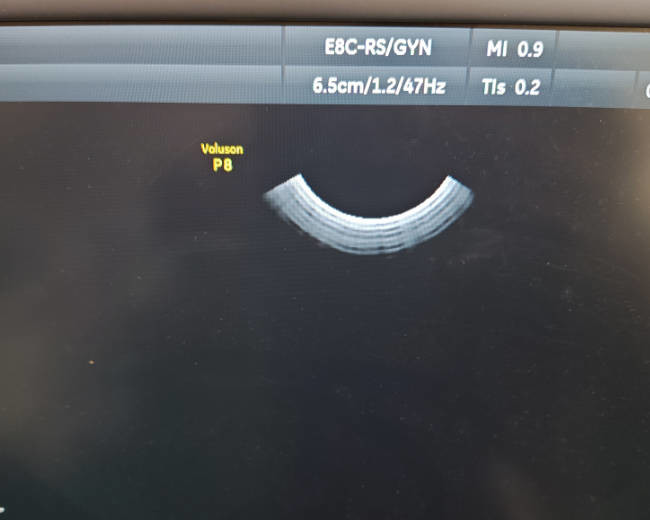 GE E8C-RS Compatible Ultrasound Probe Intracavity Transducer Electronic Diagnostics For Medical Imaging