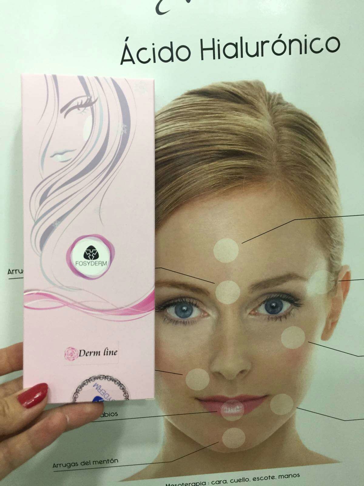 2ml Derm Hyaluronic Acid Filler Lidocaine , Lip Injections Fullness HA Gel With Lidocaine