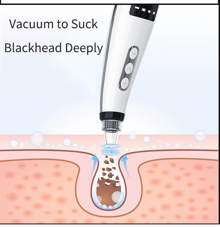 450mAh ABS USB 5 Gear Blackhead Remover Vacuum Suction Device