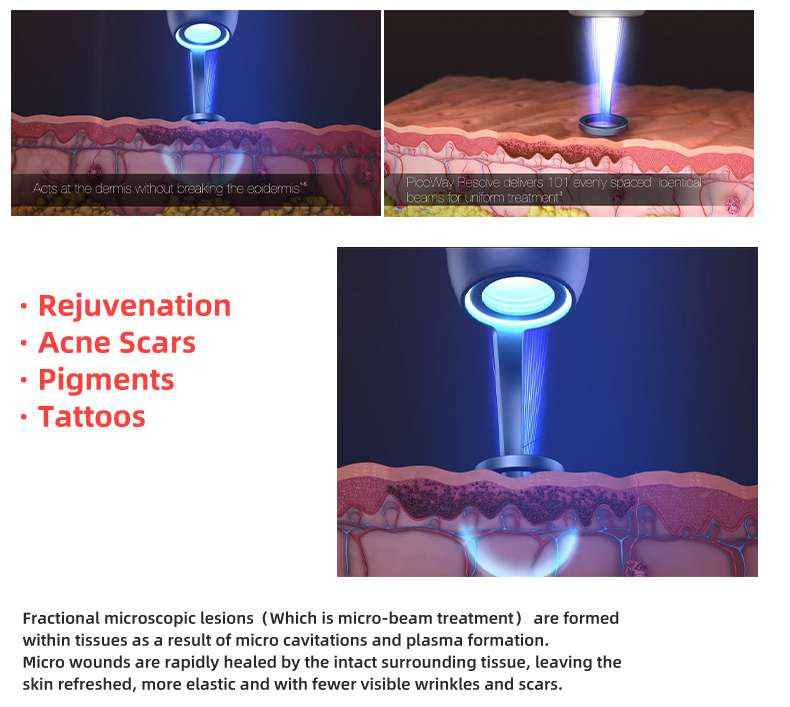 600ps Pulse 400mj Picosecond Laser Machine For Skin Whitening