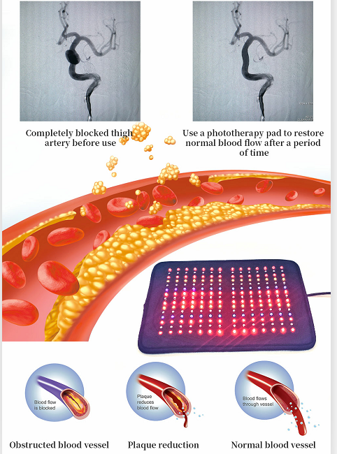 Multi Colors PDT Light Therapy Device Therapeutic Infrared Pad