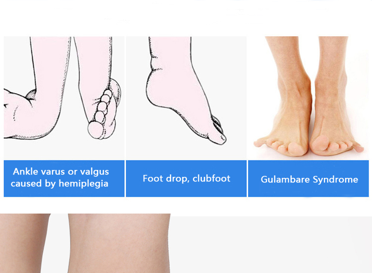 2022 New Design PP splint universal ankle foot support orthosis AFO Leaf Spring