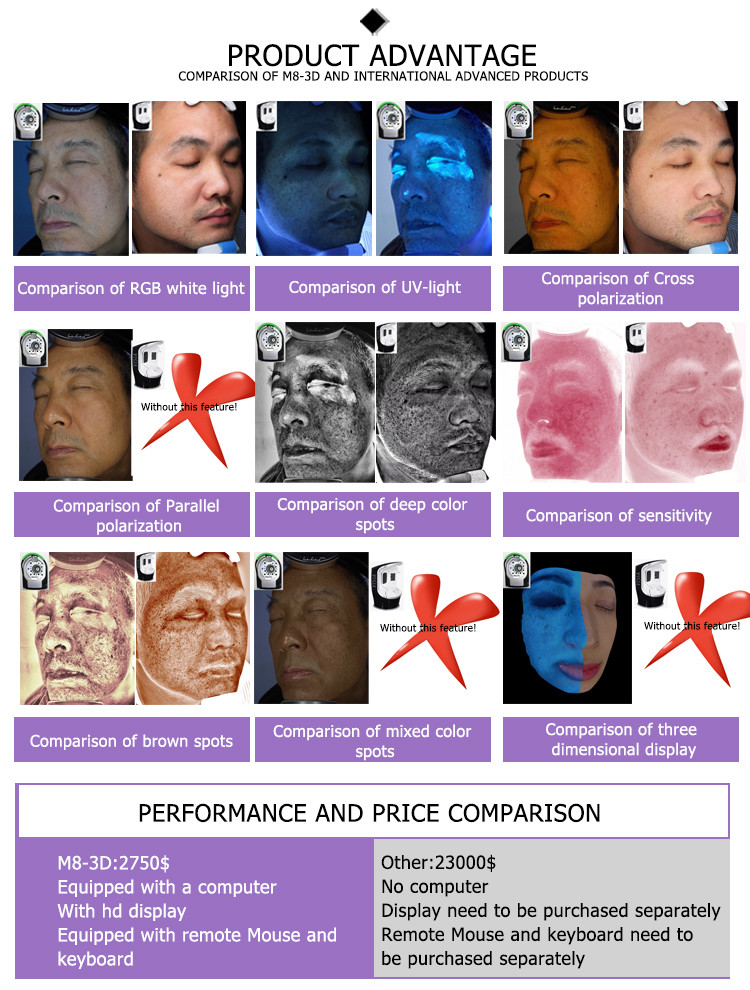 3d nls analyzer skin analysis camera OEM livre download skin analysis software to skin analyzer