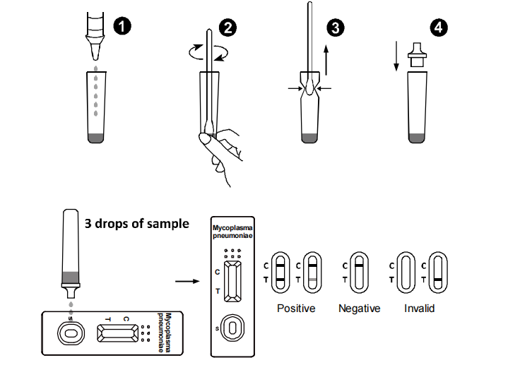 Mycoplasma Pneumoniae Antigen Test Lateral Flow Immunochromatographic Assay Test Kit