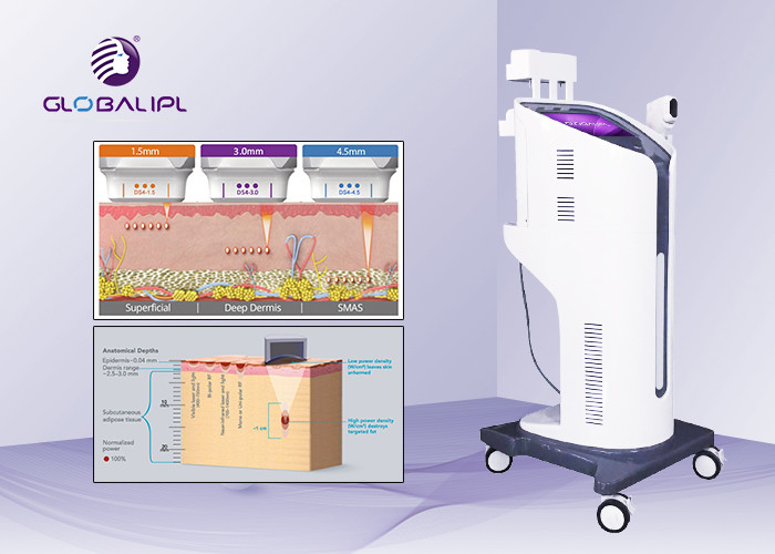 4D Wrinkle Removal HIFU Machine 4 - 7MHz Frequency With Better Curative Effect