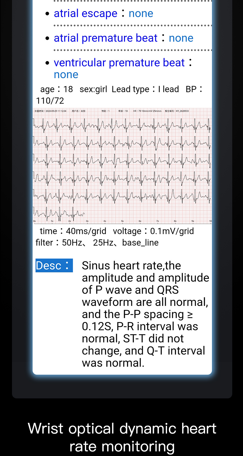 Detecting PPG ECG Temperature Bracelet IP67 Smart Bracelet Heart Rate Blood Pressure