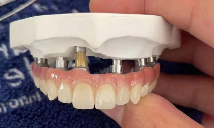 B1 B2 Colours SHT Zirconia Multilayer Block For Veneers Teeth