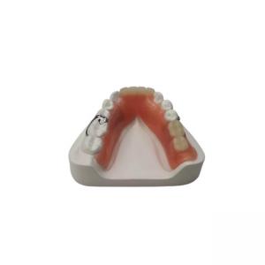 China Flexible Resin Denture Dental Lab Dental Acrylic Removable Partial Dentures on sale
