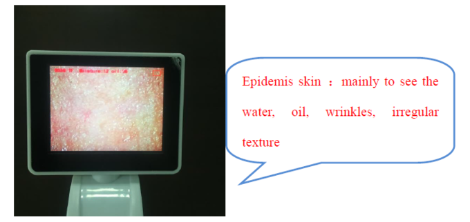 CE BS5SH Digital Skin Analyzer Digital Skin Moisture Meter For Doctor