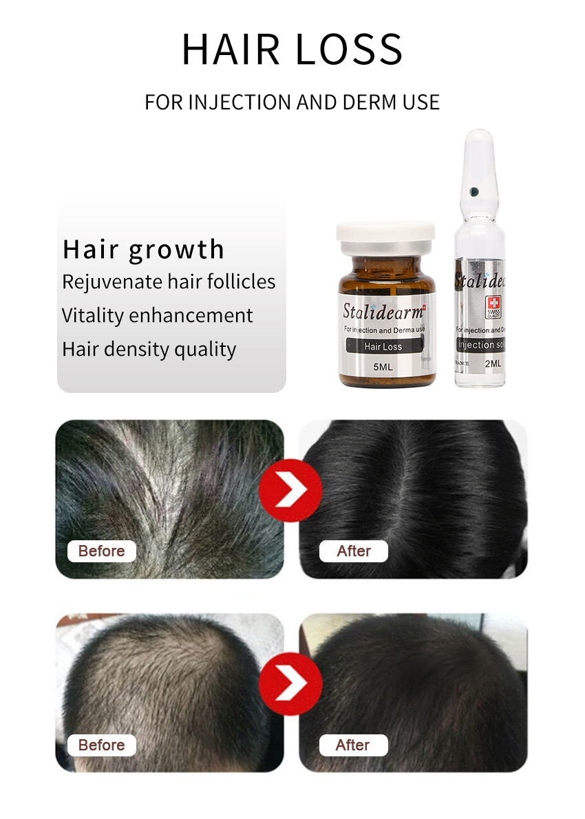 5ml Youth Serum Injection Head Skin Care PRP Injection For Hair Growth