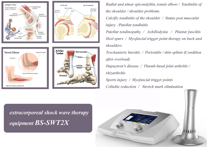 Radial / Ulnar Epicondylitis Portable Shock Therapy Machine BS-SWT2