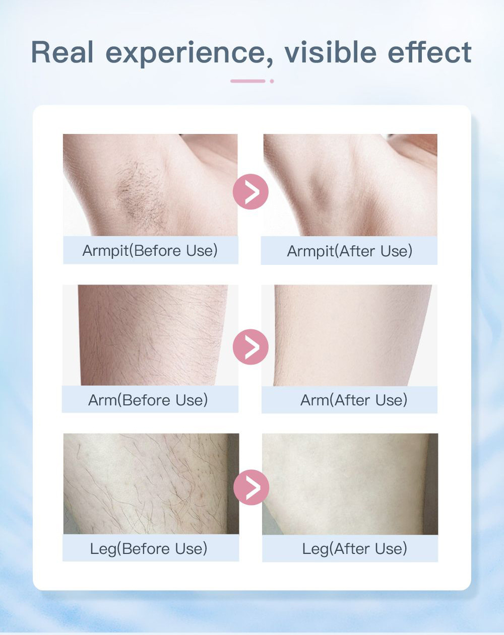 5 Levels 12V 4.0A Permanent Hair Removal Machine For Home Use
