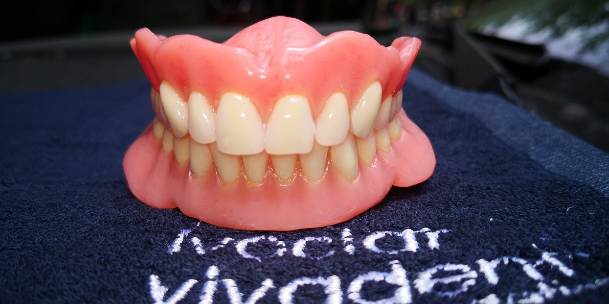 Full Arch Acrylic Partial Denture