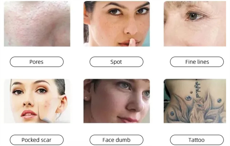 Professional 12*26mm Spot Diode Laser Hair Machine Vertical Style Skin Rejuvenation
