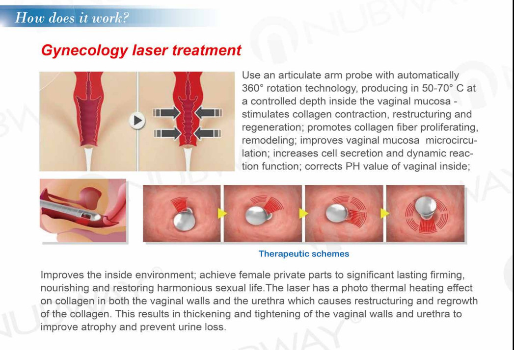 Fractional CO2 Laser Equipment Fractional CO2 Laser Acne Scar Removal