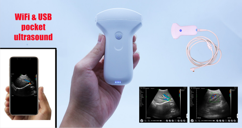 G10UR G10UL Medical Hospital Equipments Ultrasound USB Probe Wireless Transducer