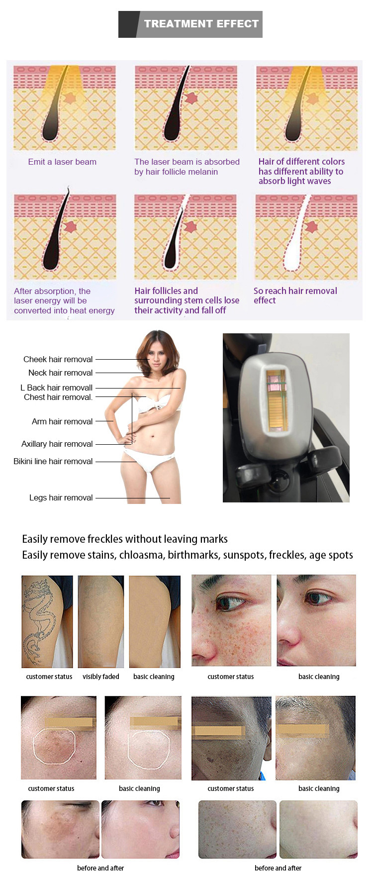 810 Pigment Removal Machine , Portable 2 In 1 IPL Beauty Laser Tattoo Removal Machine