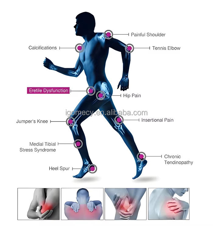 Skin Tightening Ultrawave Therapeutic Ultrasound Machine Ultrasonido Physical Ultrasound Physiotherapy Equipment
