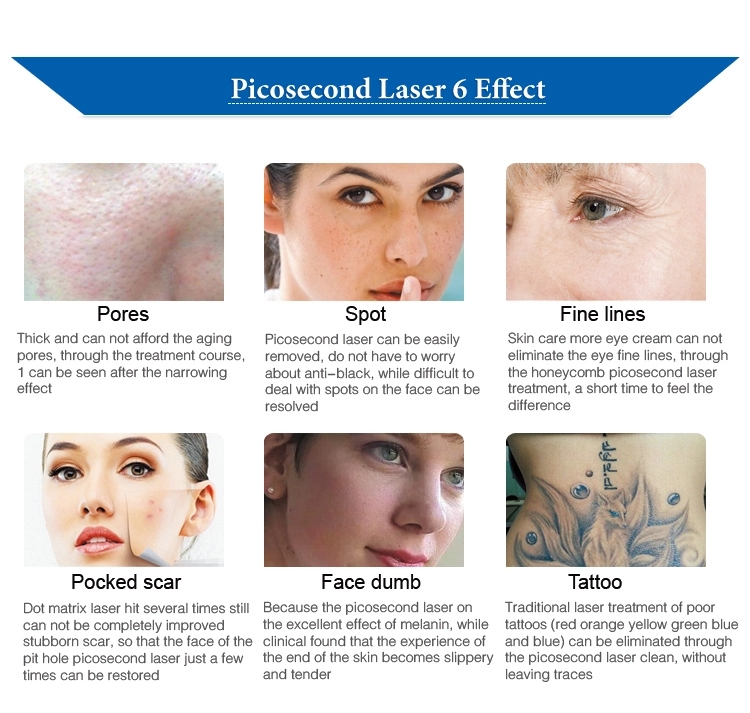 Skin Treatment Pico Laser Tattoo Removal Machine , 2000W Q Switch ND YAG Laser