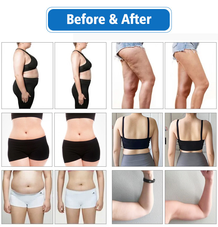 Non Surgical Body Shaping Slimming Machine 1100W With 10D Contour System