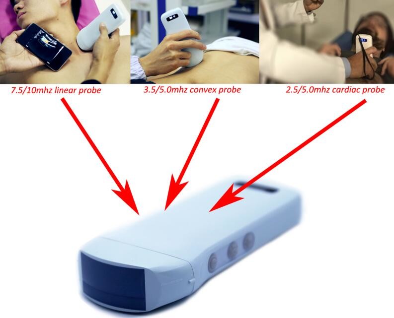 128 Elements Medical Hospital Equipments Color Doppler Portable Wireless Ultrasound Machine 3 In 1