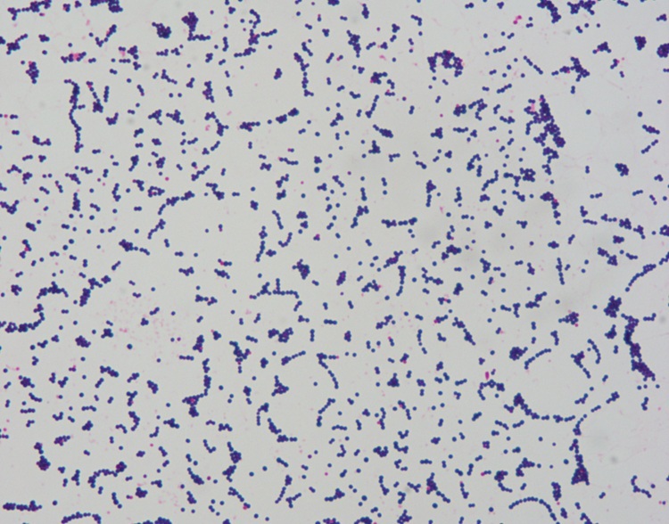 5x1000ml Clinic Gram Stain Reagents For Auto Stainer IVDR Class A Certified
