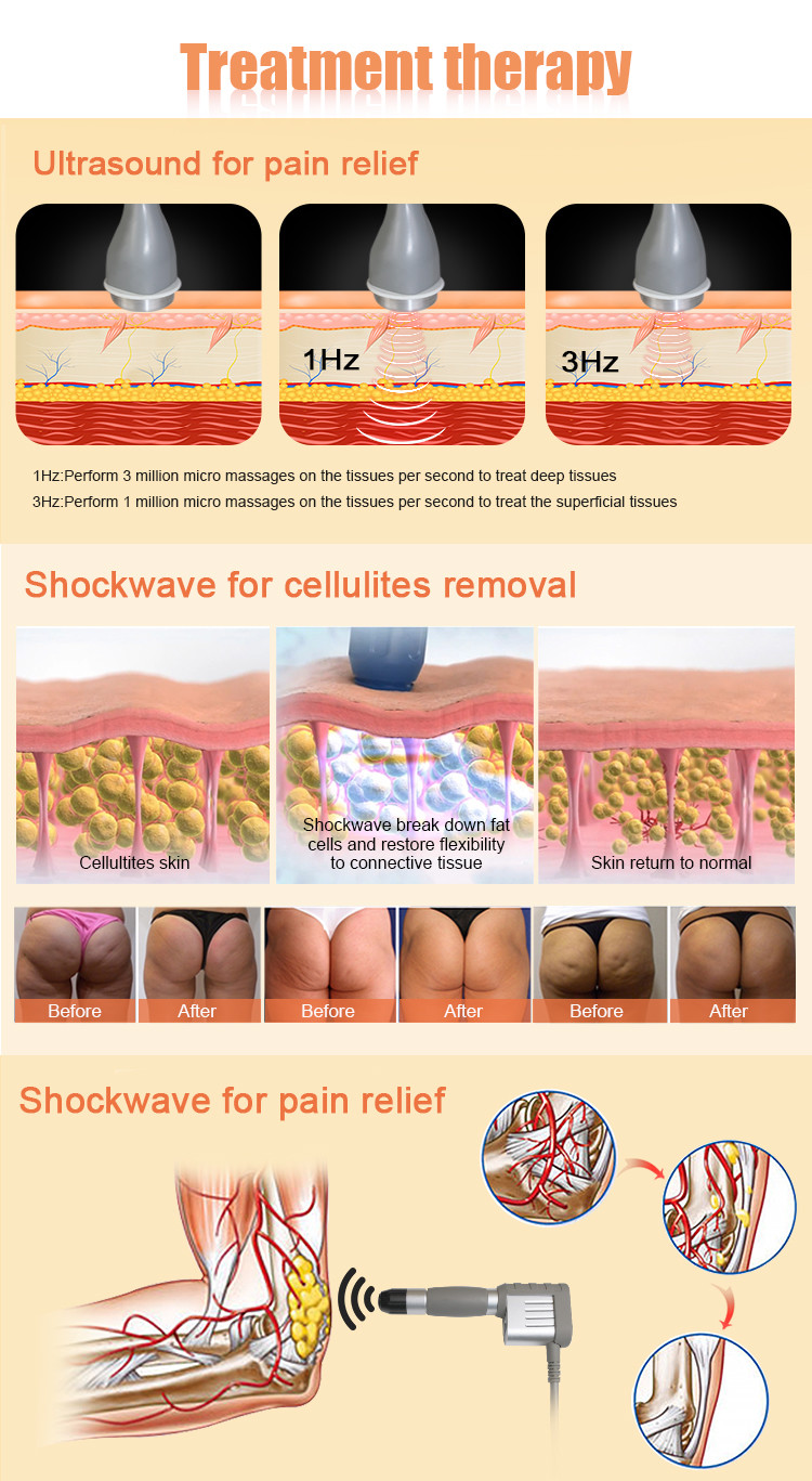 Ultrasound Eswt Shockwave Therapy Equipment Medical For Physiotherapy Pain Relief