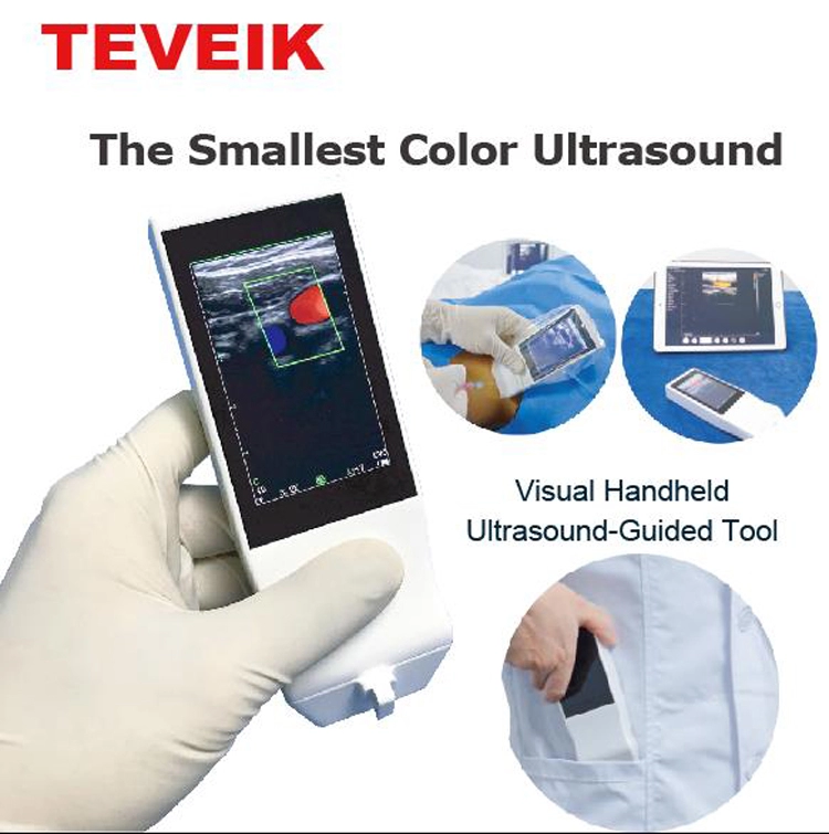 3.5W 7MHz Ultrasound Scanner Doppler Probe Lithium Battery