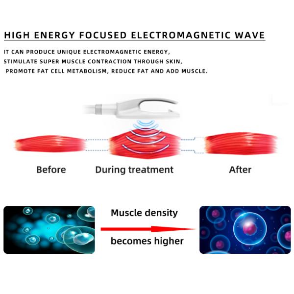 Top 5 selling Portable Ems Body EMShape Em Slim Neo Muscle Stimulator Machine / Ems Neo Rf Slimming Machine