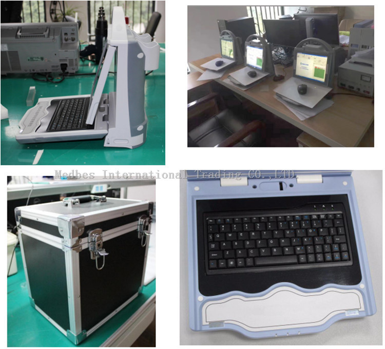 Automatic High Effective Ultrasound Bone Densitometer/Portable Ultrasound Bone Densitometer