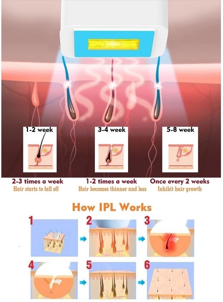 350000 Flashes 390g 4cm2 Air Cooling Laser Hair Removal