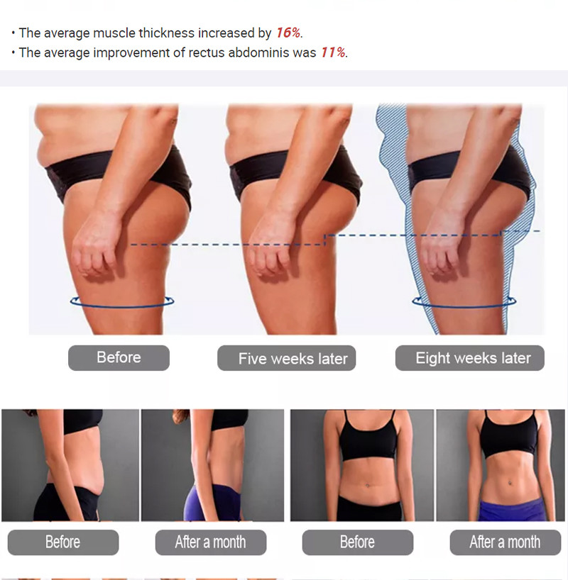 EMS Home muscle-building Magnetic Lean plus Roller magnetic shaping sculpt fat removal slimming body firming skin burning