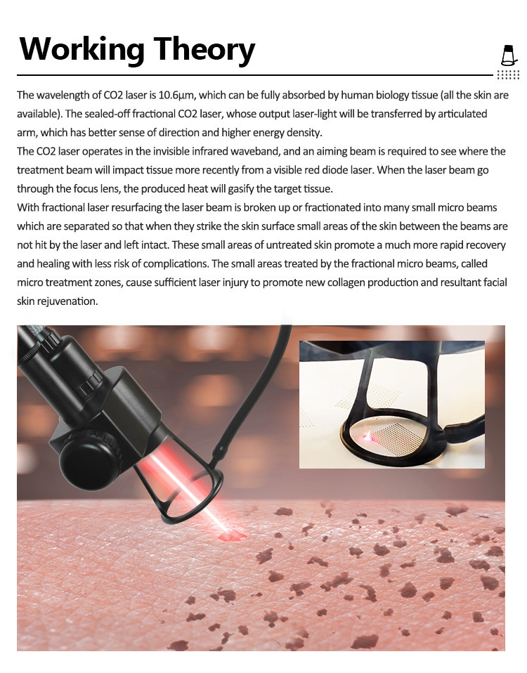 Co2 Fractional Laser Machine Designed By R D Shell Design Department For Pigmentation Removal