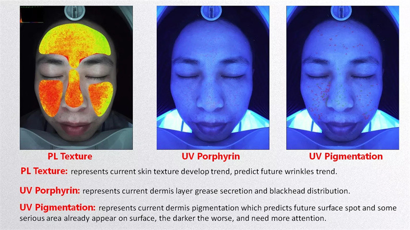 Portable Ai 20 Million Facial Scanner Skin Analyzer 3d Uv Magic Mirror