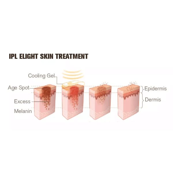 Dual Heads 7 Filters Ice Ipl Laser Hair Removal Machine Portable Hair Remover