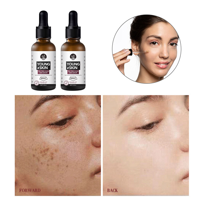 1oz/30ml OEM Organic Tea Tree Relief Essence Face Serum Repair Acne Pimple Remover