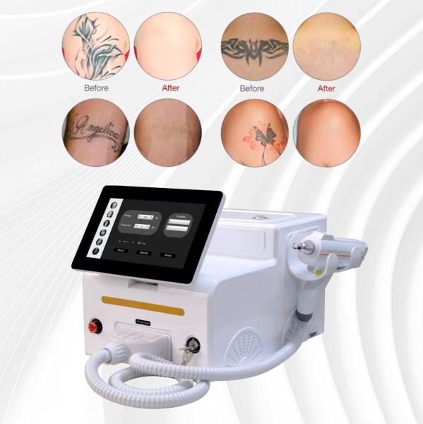 Skin Whitening Nail Fungus Laser Treatment Machine 1064nm 532nm 1320nm