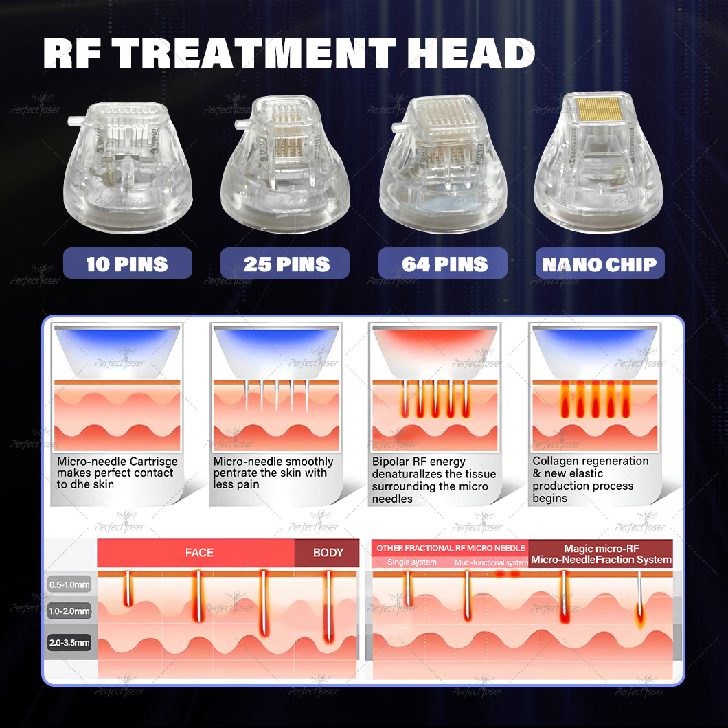 15.6 Inch Ultra-large HD Screen HIFU Skin Rejuvenate Manufactueruer Info