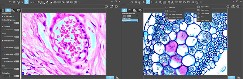 infinity Plan Achromatice Compound Optical Microscope 3W LED A12.1502 Backward Quadruple Nosepiece