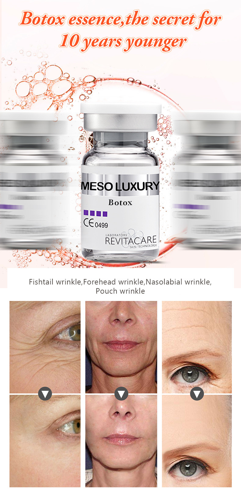 whitening MESO BOTOX Serum Microneedling Serum Mesotherapy Serum For Face