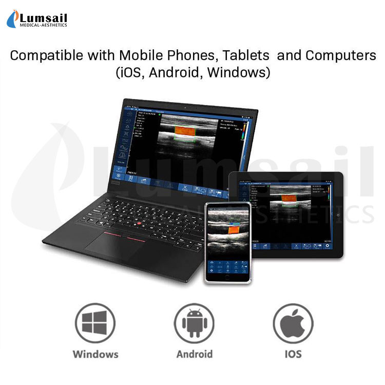 Linear Convex Phased Array 3 In 1 Handheld Pocket Ultrasound Scanner With APP