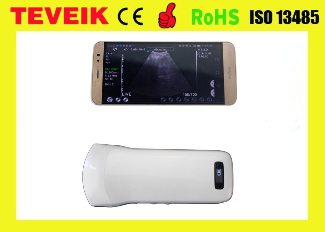 Factory Price High Imaging Medical Portable Wireless Handheld Convex Ultrasound Probe Transducer