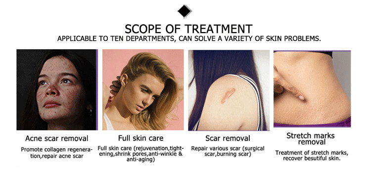 New arrival hot selling CE approved input 1000W co2 fractional forever beauty laser device