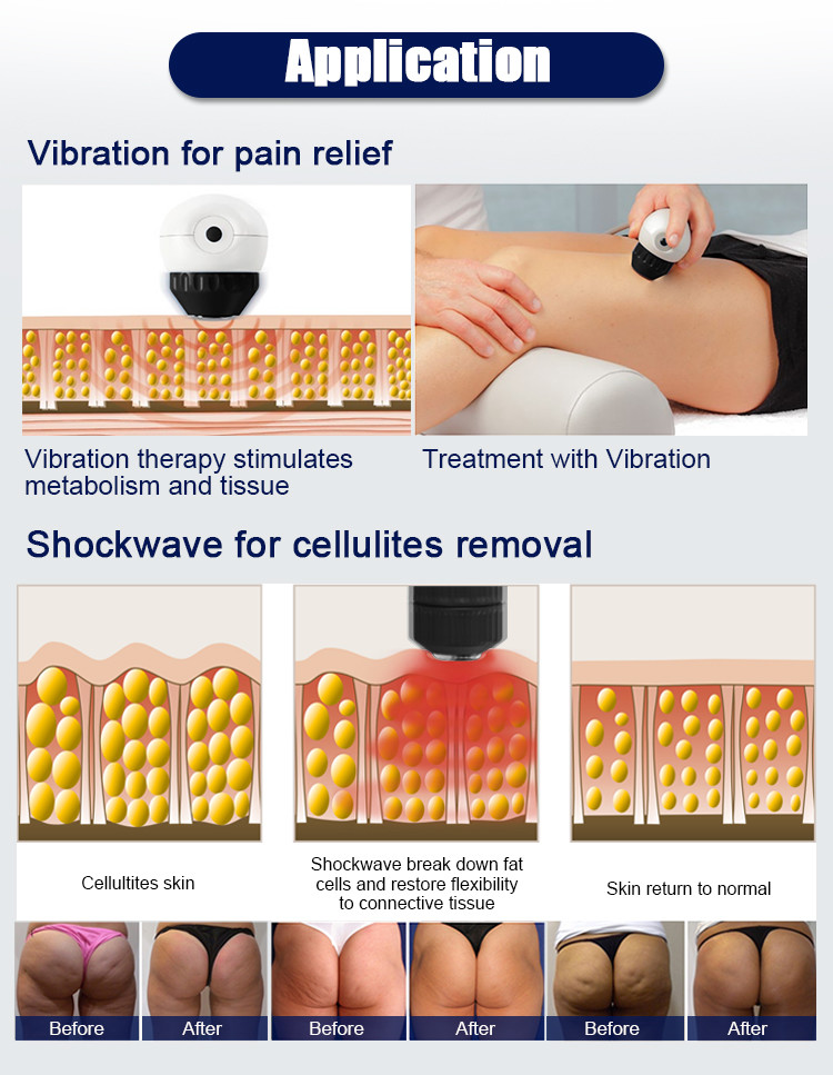 Shockwave Physical Therapy Pain Relief Therapy Knee Medical Machine Shock Wave Therapy