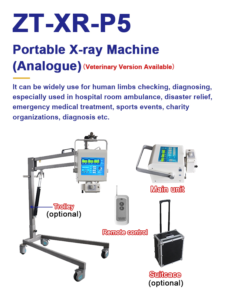 Mobile Portable Digital X Ray Equipment Radiography Diagnosis 100mA LCD Screen