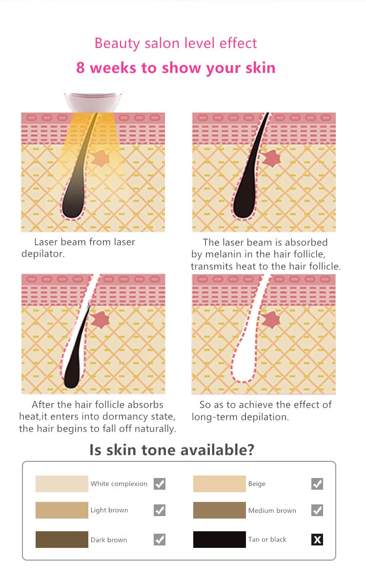 10 Minutes Full Body anti allergy Laser Hair Removal Handset