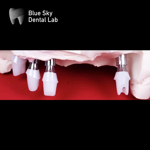 Biocompatibility Zirconia Abutment Custom Zirconia Implant Abutment White