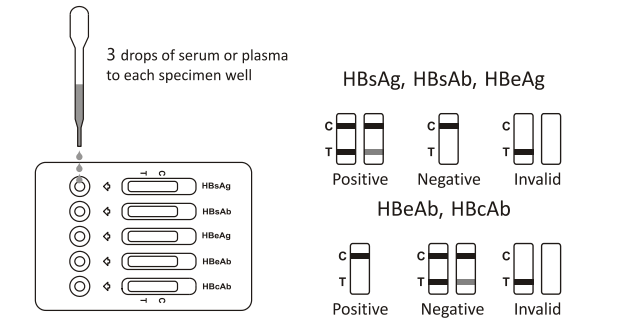 15 Minutes HBV Combo Rapid Test Cassette HBsAg Rapid Test Dipstick