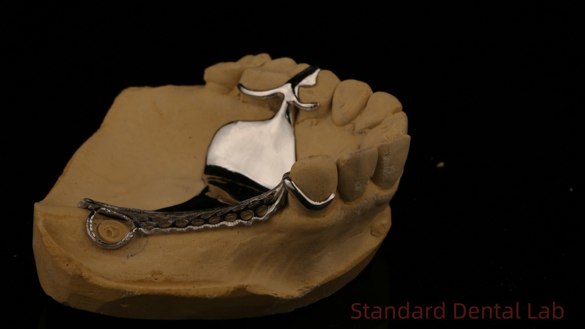 High Strength 3D Printed Cast Framework COCR Partial Dentures Chrome Cobalt Cast Metal Framework