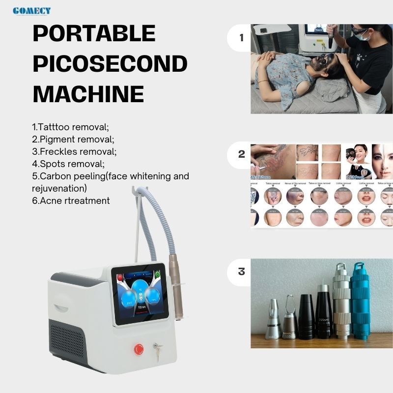 Gomecy Pro ND YAG Pico Laser Machine for Treating Facial Pigmentation and Scars and Tatttoo Removal